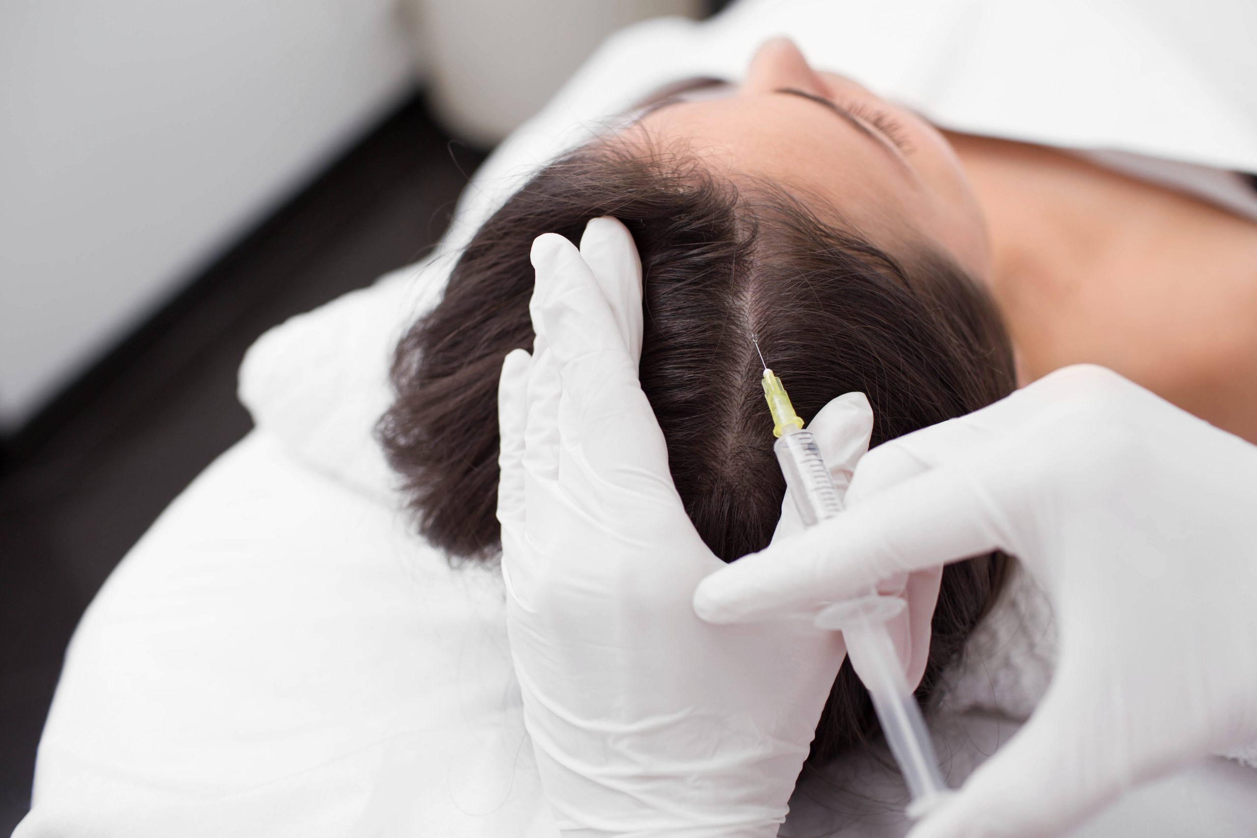 Injections P.R.P. – Cheveux